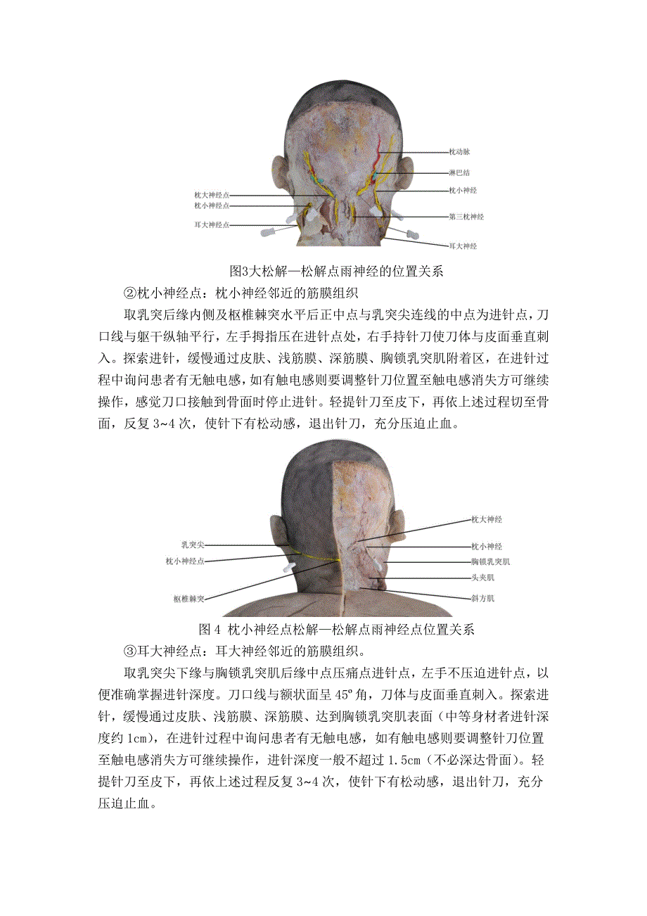 头痛（颈源性头痛）中医诊疗方案2018版_第4页