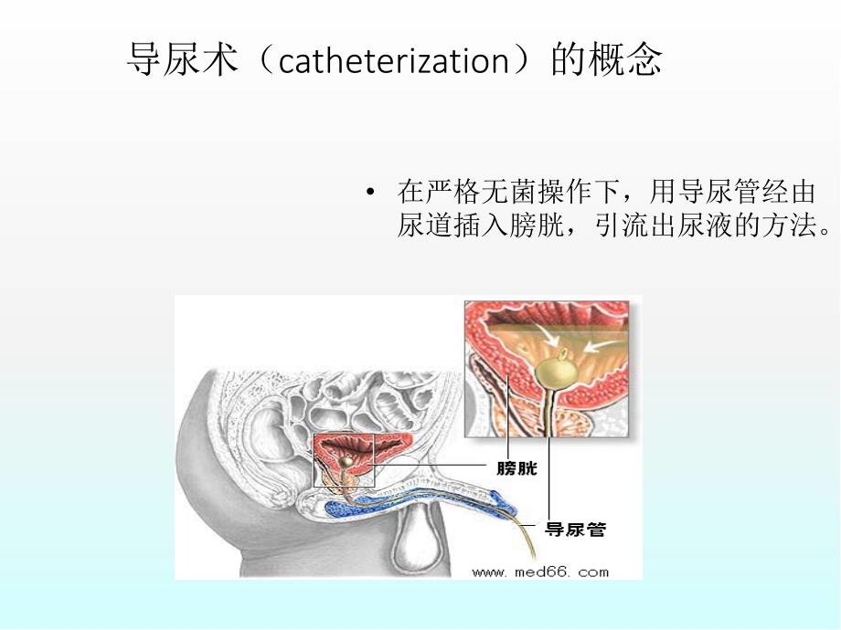 男性导尿常见问题防范及处理医学PPT课件_第3页