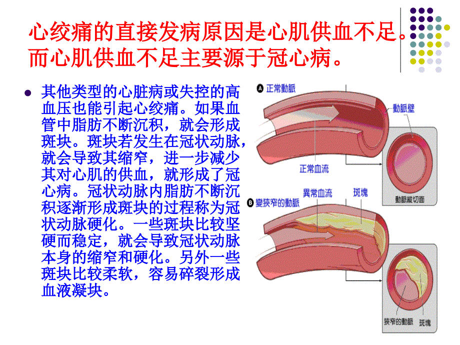 心绞痛的急救_第4页