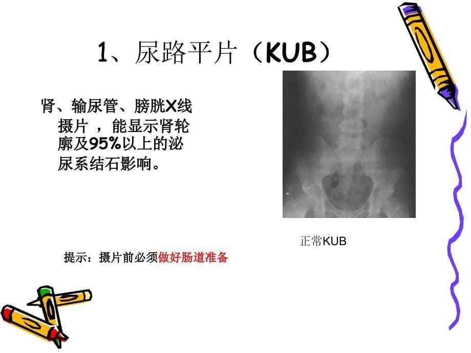 膀胱镜检查课件_第5页