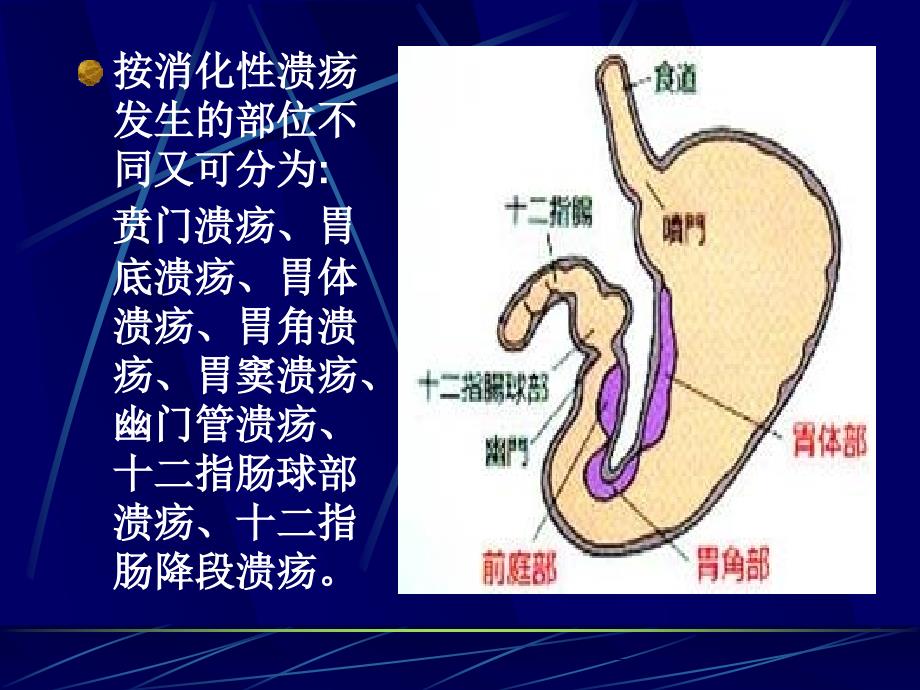 内科学消化性溃疡_第3页