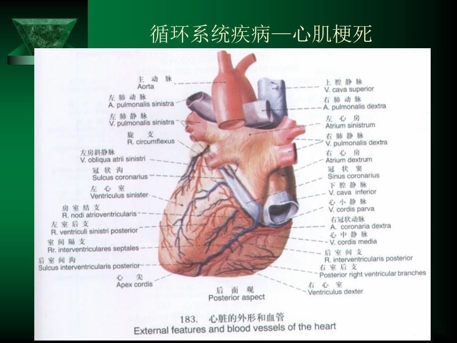 循环系统疾病心肌梗死_第5页