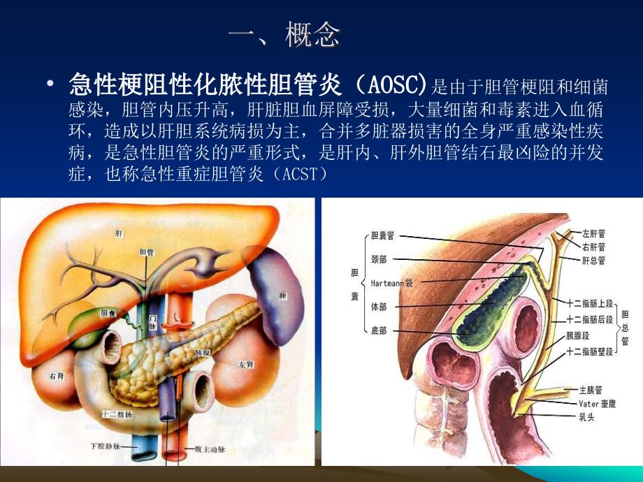 急性梗阻性化脓性胆管炎_第2页