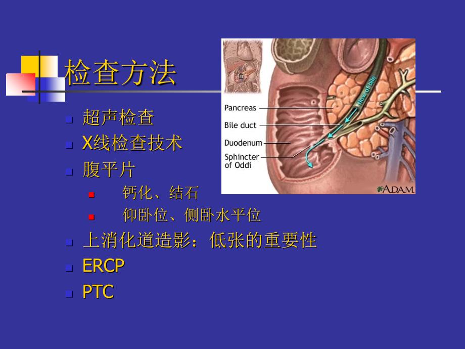 胰腺CTPPT课件PPT文档_第2页