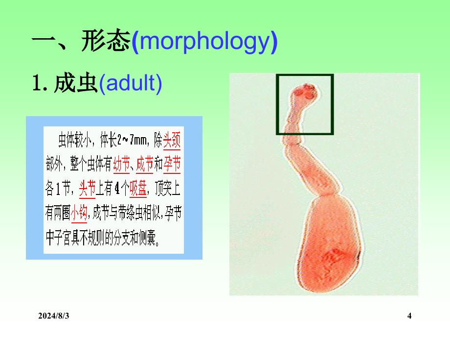 人体寄生虫学课件：细粒棘球绦虫_第4页