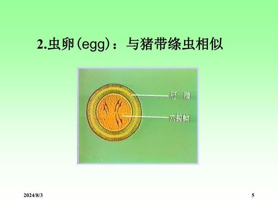 人体寄生虫学课件：细粒棘球绦虫_第5页