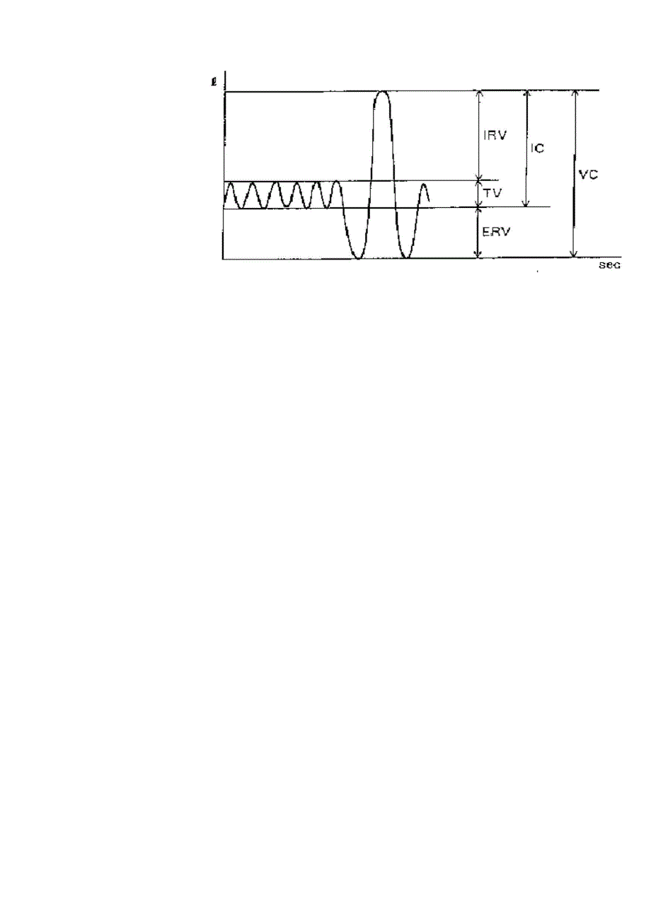 肺功能临床评价_第4页