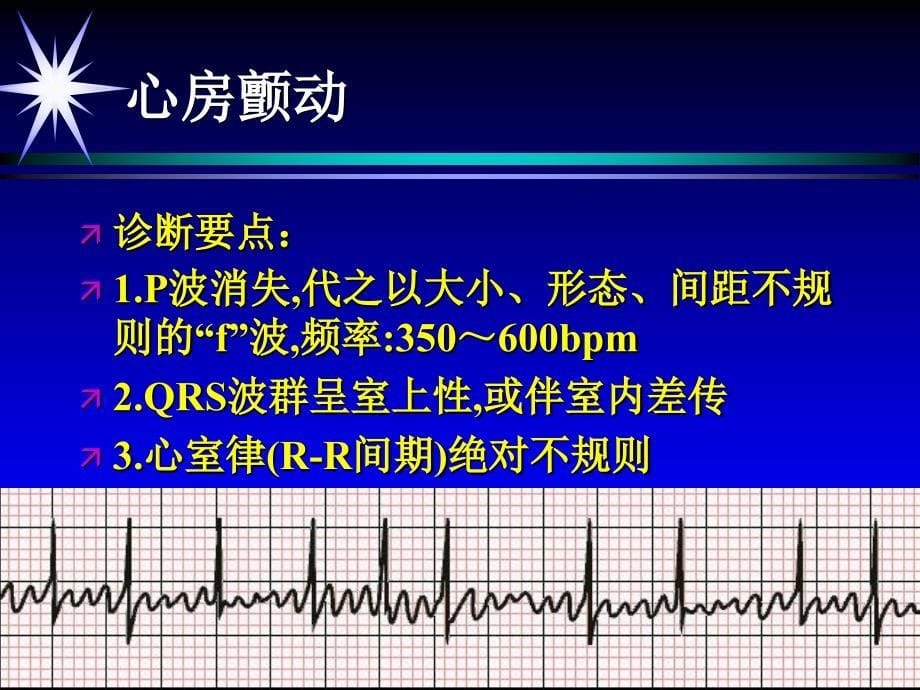 急救培训(心电图).ppt_第5页