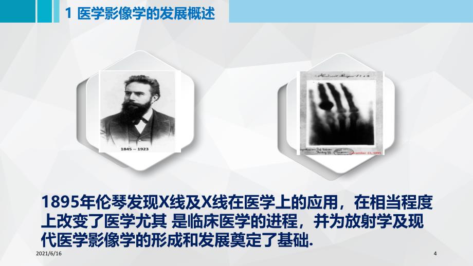 医学影像学发展史_第4页