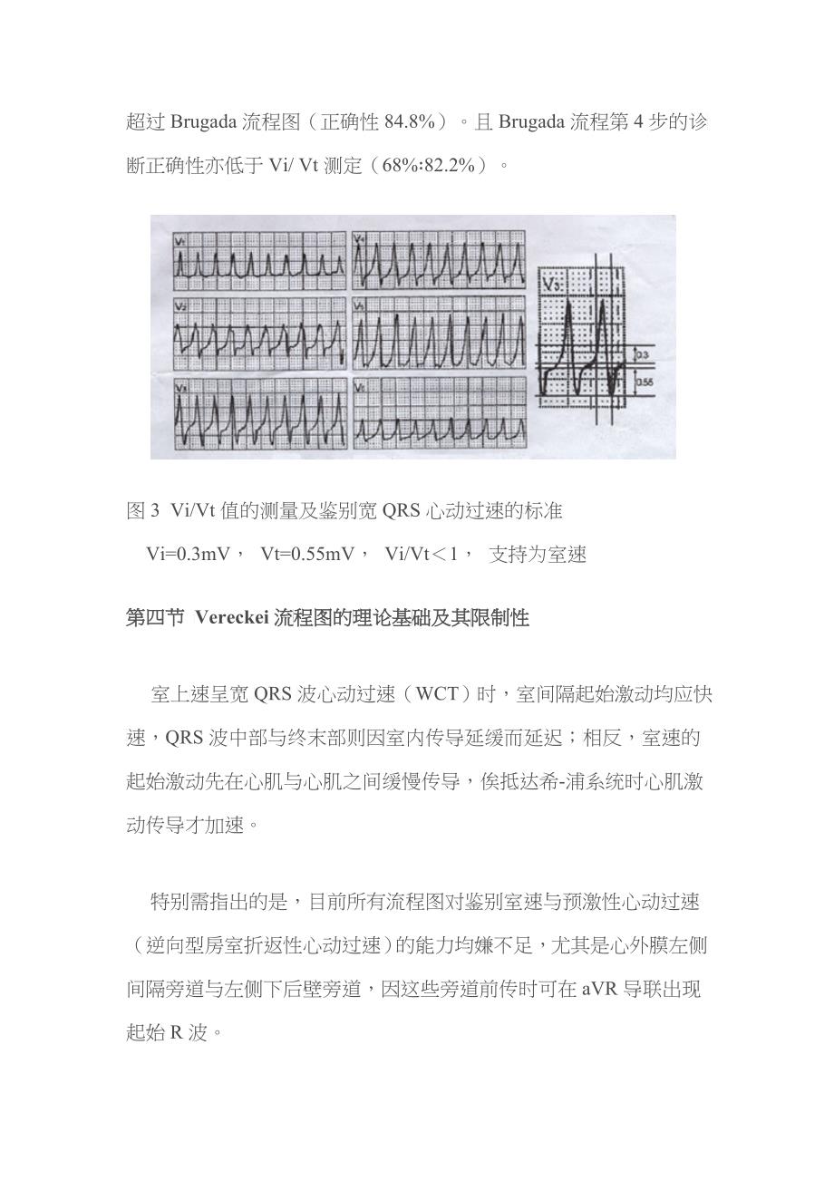 宽QRS波心动过速鉴别诊断流程的演变_第4页