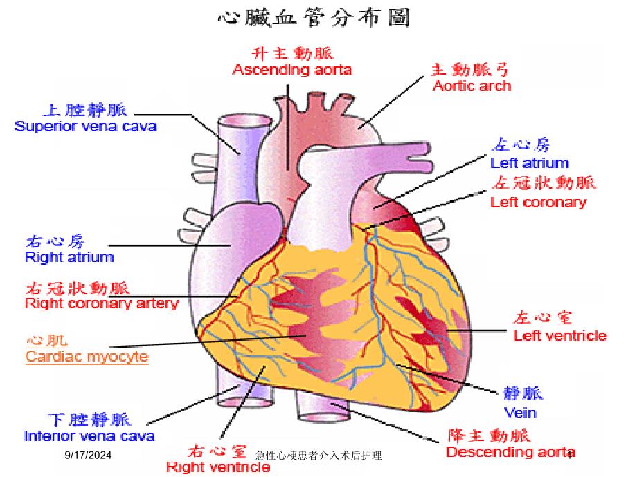 急性心梗患者介入术后护理培训课件_第1页