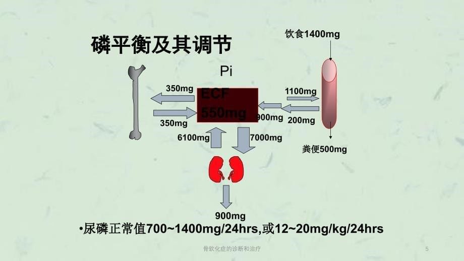 骨软化症的诊断和治疗课件_第5页