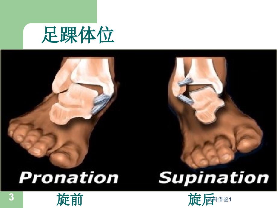 踝关节骨折与脱位的诊治（行业荟萃）_第3页