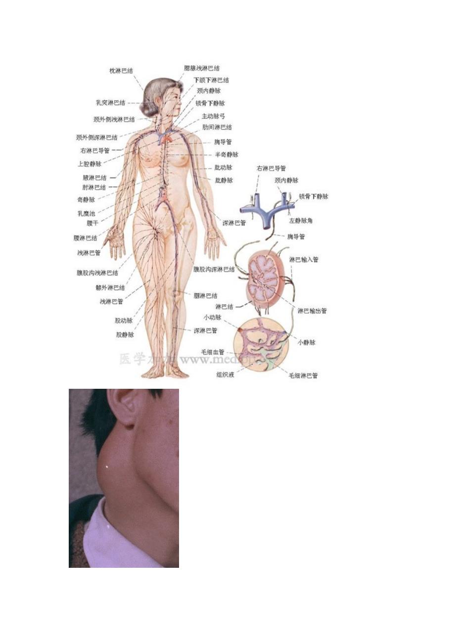 专业医治淋巴结、鼻咽癌、淋巴瘤.doc_第3页