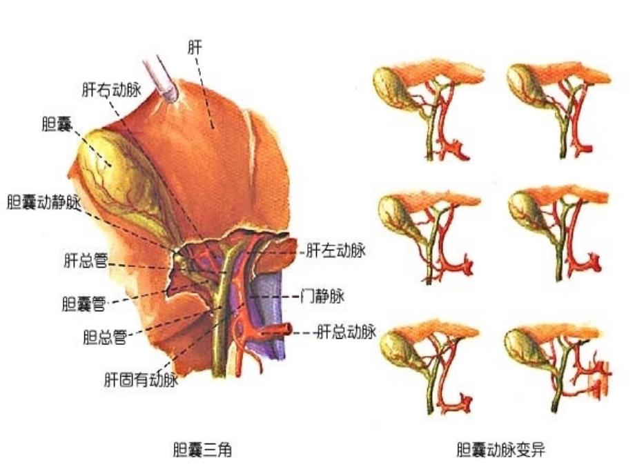 胆道病课件文档资料_第4页