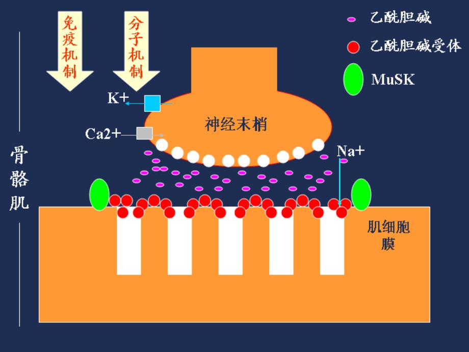 重症肌无力(赵重波).ppt_第4页