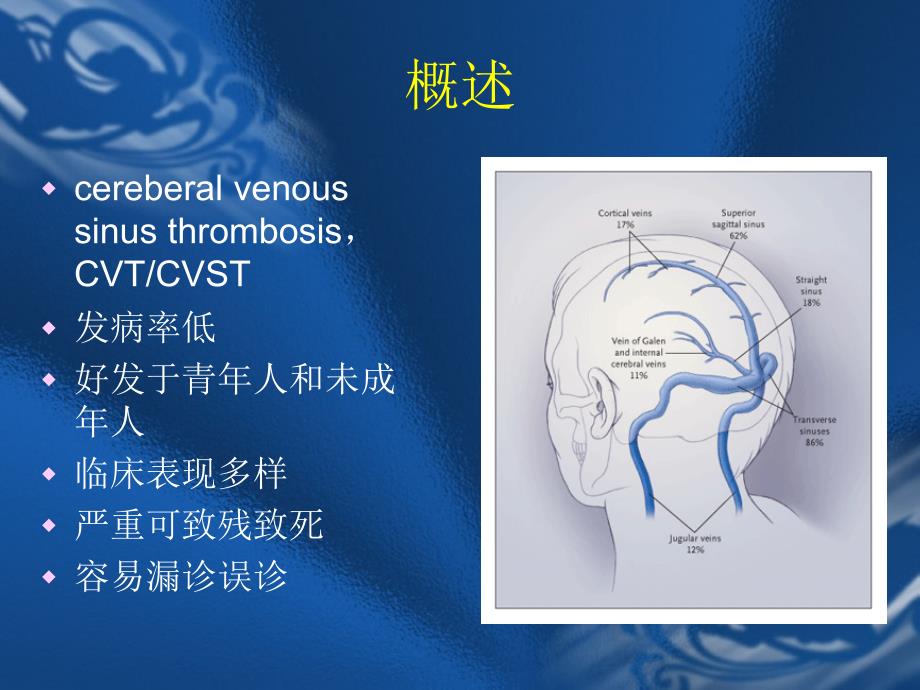 颅内静脉窦血栓形成诊治体会.ppt_第2页