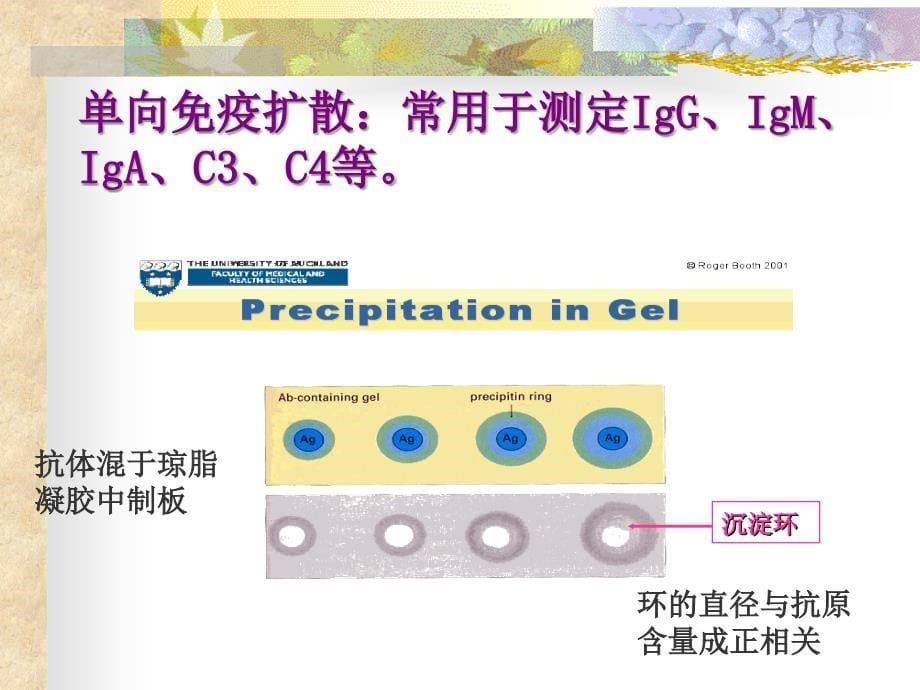 抗原抗体反应的应用课件_第5页