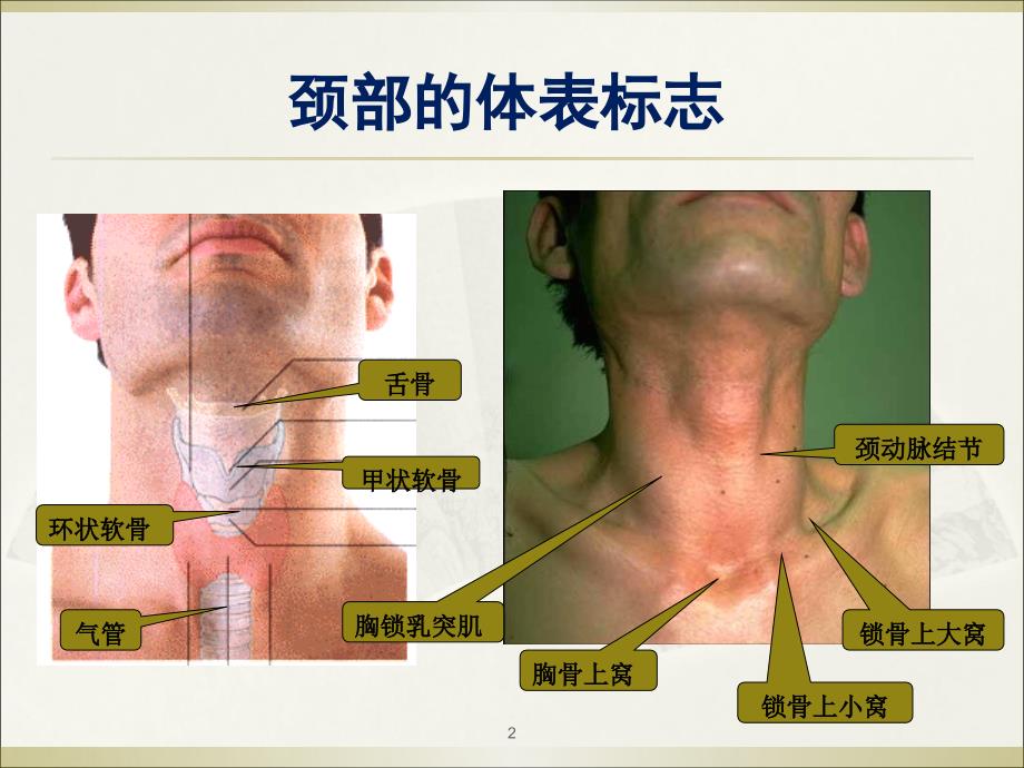 气管切开术上课讲义_第2页