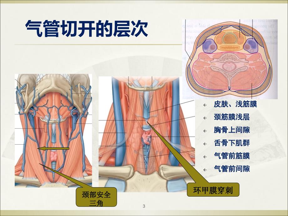 气管切开术上课讲义_第3页