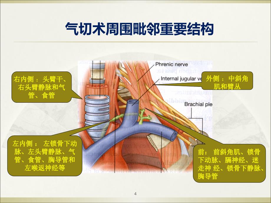 气管切开术上课讲义_第4页