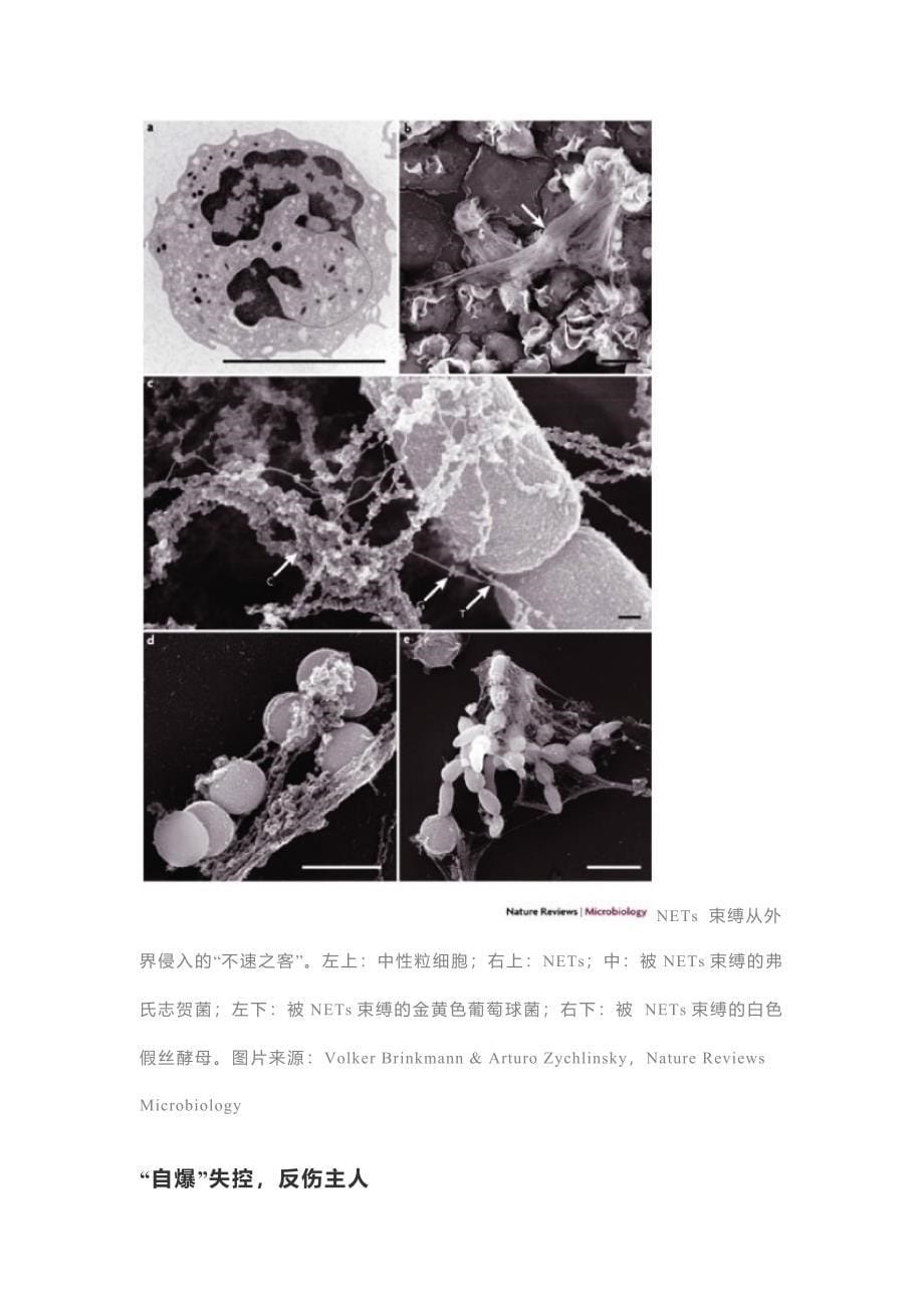 抗菌天网-中性粒细胞_第5页