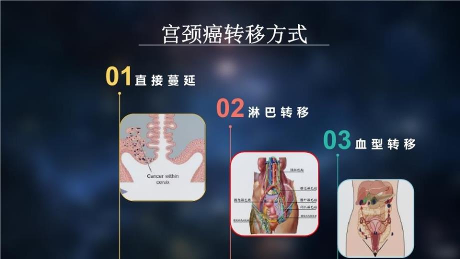 宫颈癌新分期指南(2)讲课讲稿_第3页