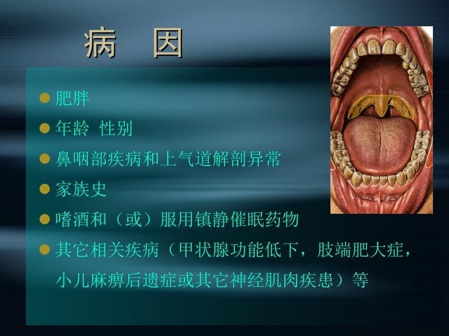 hx10睡眠呼吸暂停低通气综合征名师编辑PPT课件_第5页