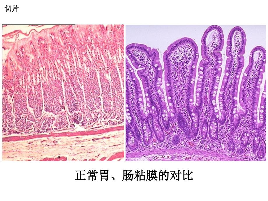 泸州医学院病理切片全_第2页