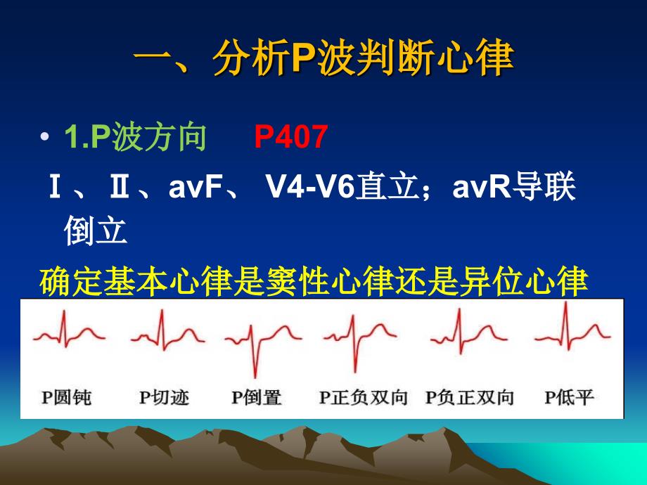 心电图学小结_第4页