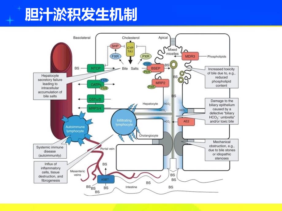 肝内胆汁淤积的诊断步骤与治疗要点_第3页