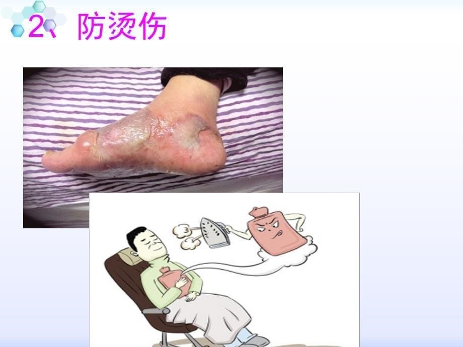 老年人的日常生活及环境护理.ppt_第5页