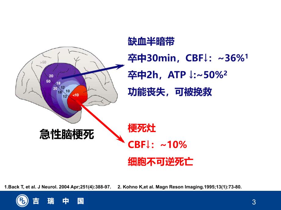 《挽救缺血半暗带》PPT课件_第3页