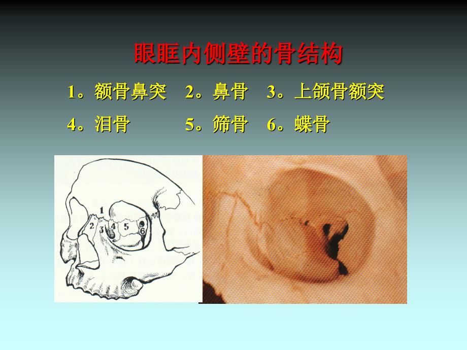 内窥镜鼻眼相关外科简介_第4页