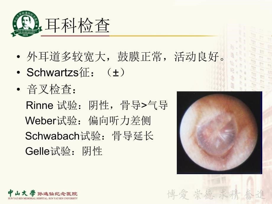 《耳鼻咽喉-头颈外科学》教学课件：4-耳硬化症_第5页