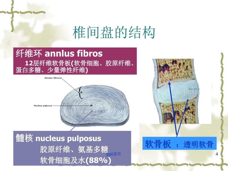 腰椎术后并发症及护理ppt课件_第4页