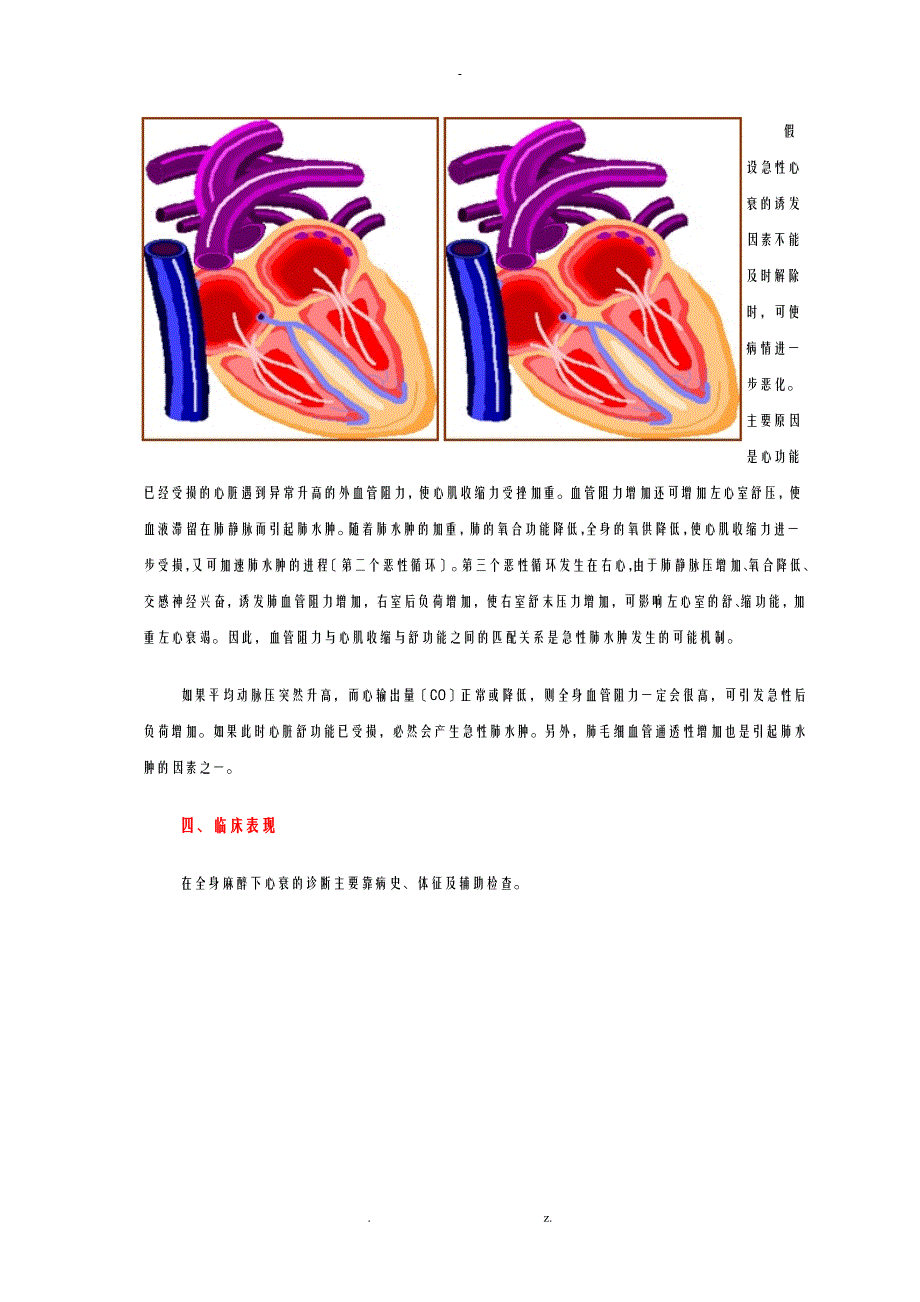 心衰患者围麻醉期管理_第4页