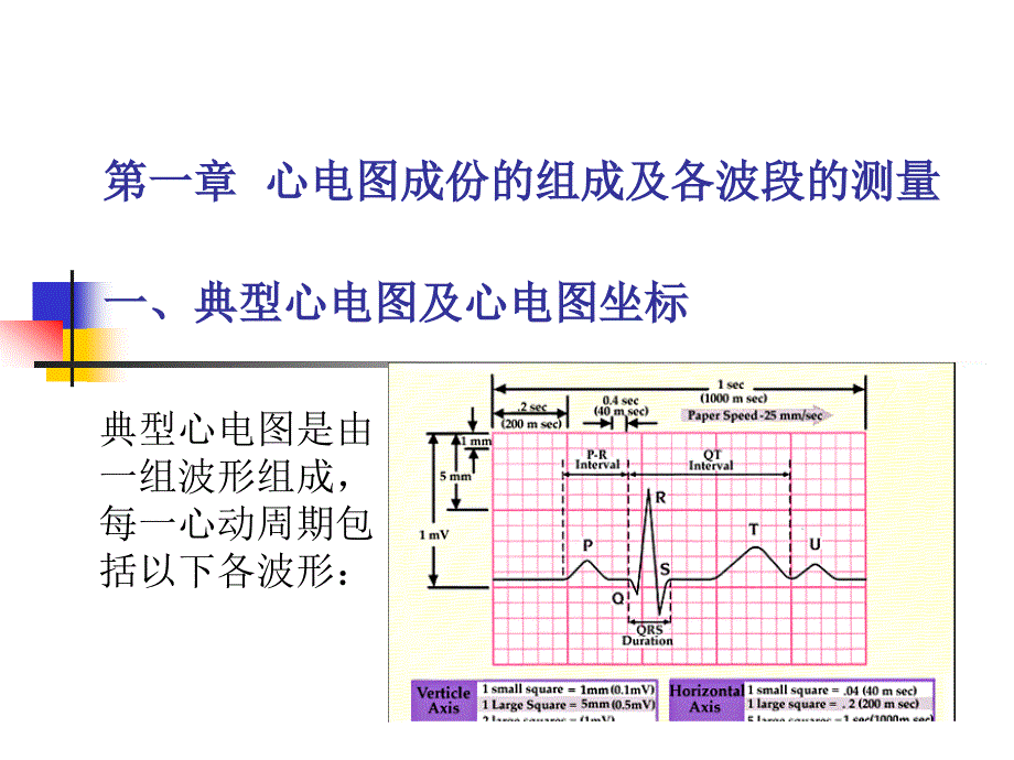 儿童心电图特点课件.ppt_第2页