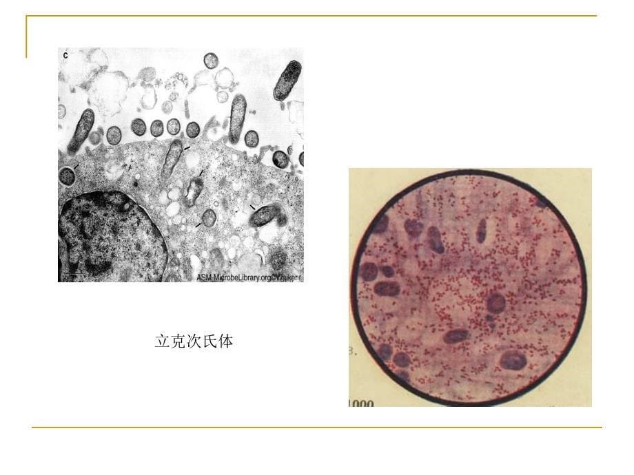 立克次体衣原体课件_第5页