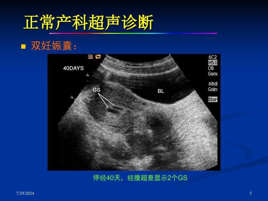 妇产科超声检查(完整版)_第5页