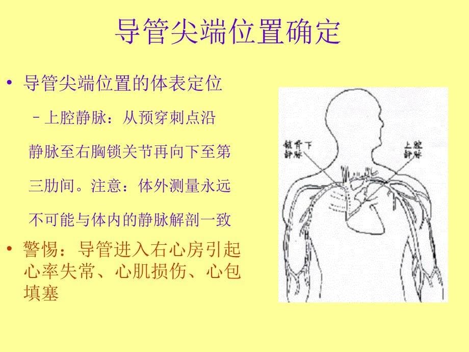 PICC置管术相关知识_第5页