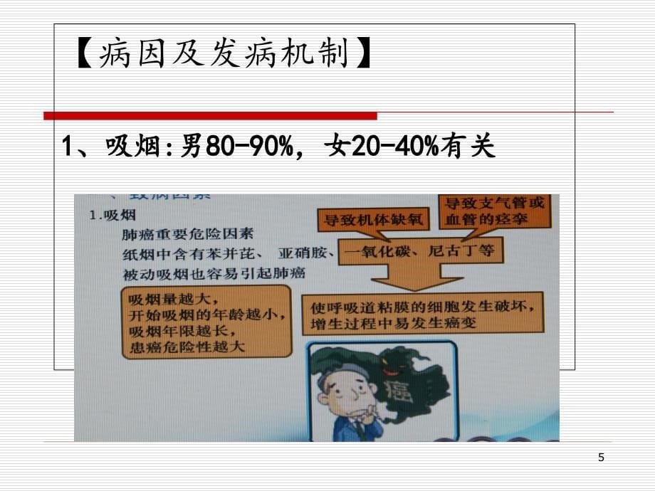 原发性支气管肺癌病人的护理医学课件_第5页