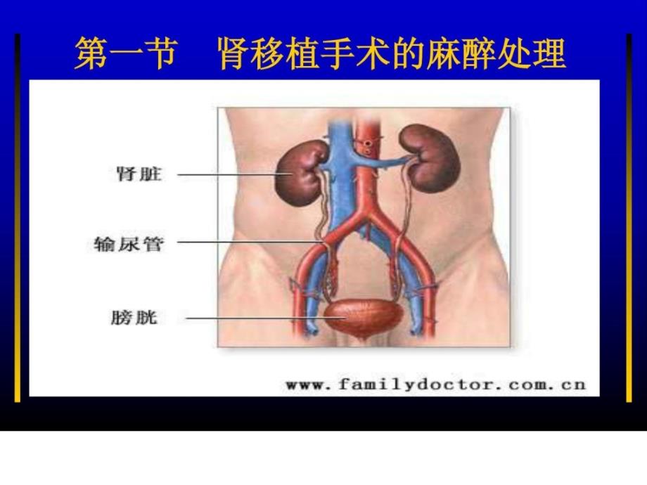 罕见器官移植手术的麻醉.ppt_第2页