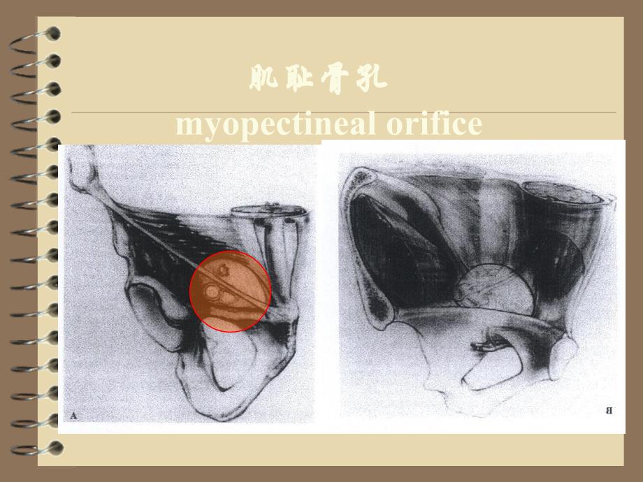 腹腔镜腹股沟疝修补术_第3页