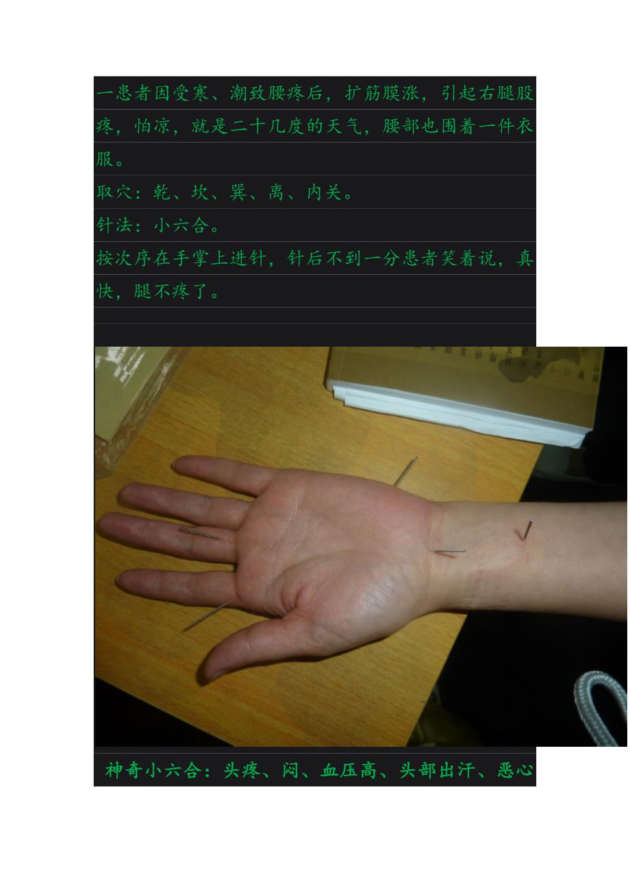 神奇小六合针灸法_第1页
