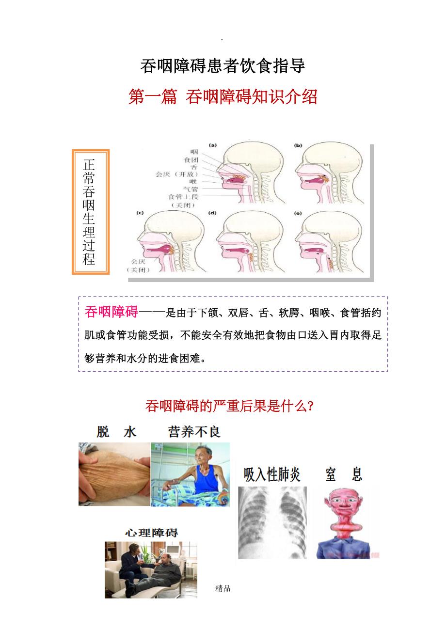 吞咽障碍饮食_第1页