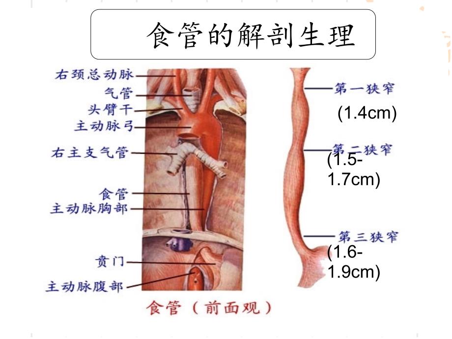 食道癌护理学查房_第4页