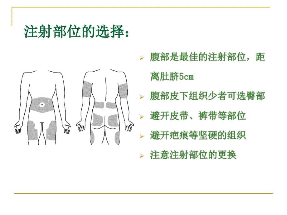 胰岛素泵的操作演练概述.ppt_第5页