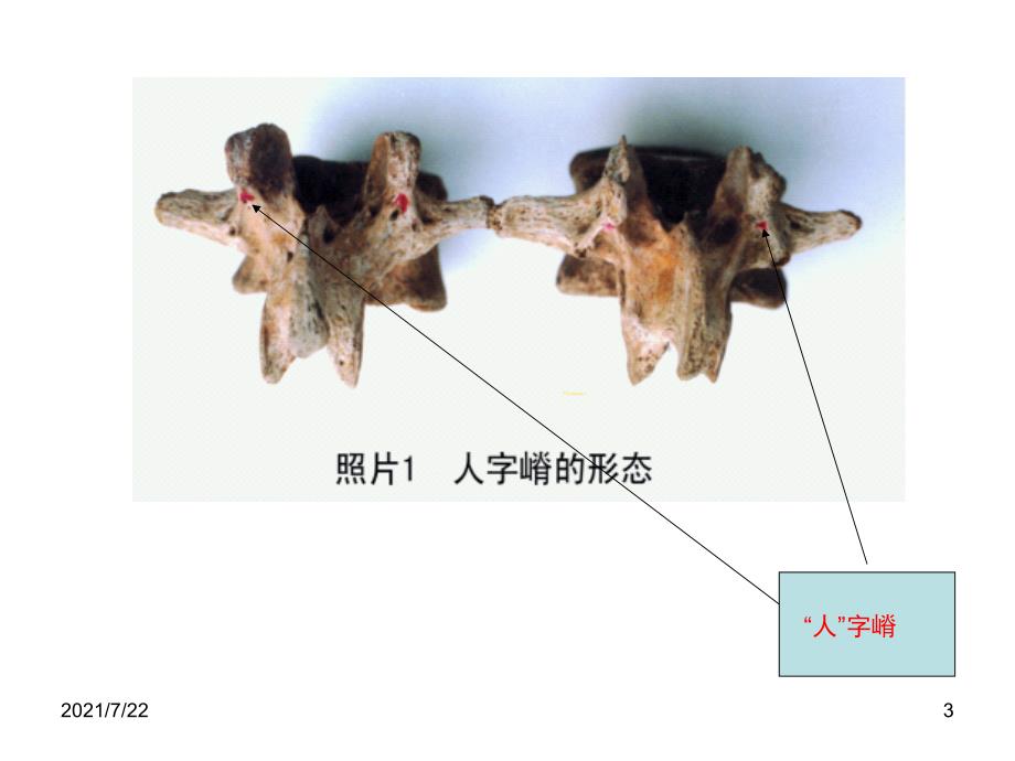 人子脊解剖PPT课件_第3页