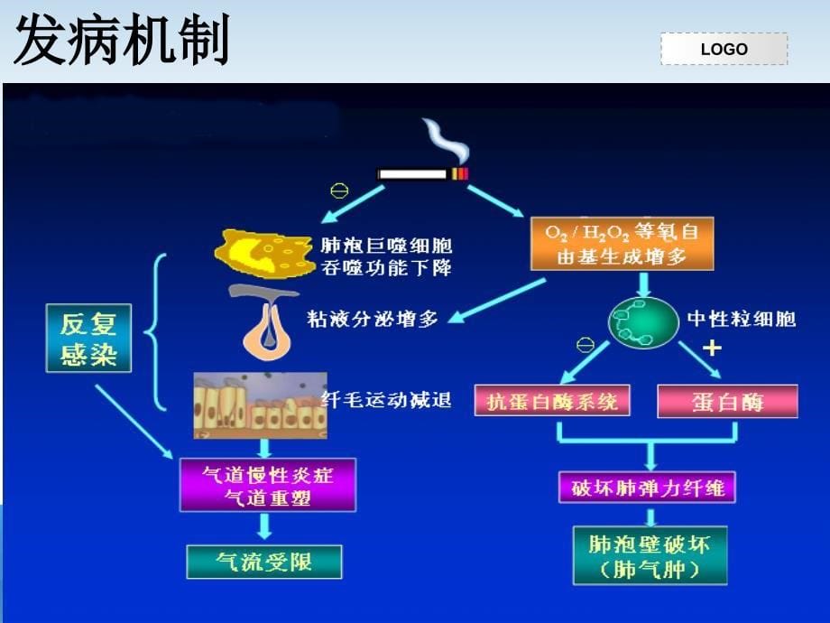 慢性阻塞性肺气肿_第5页